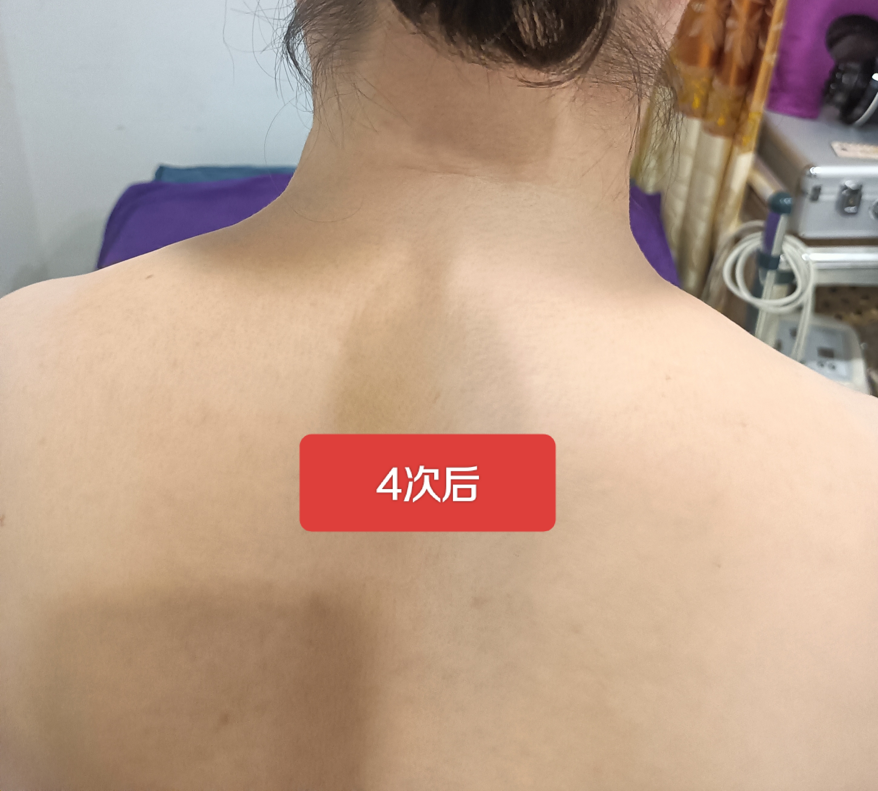 富贵包调理/次