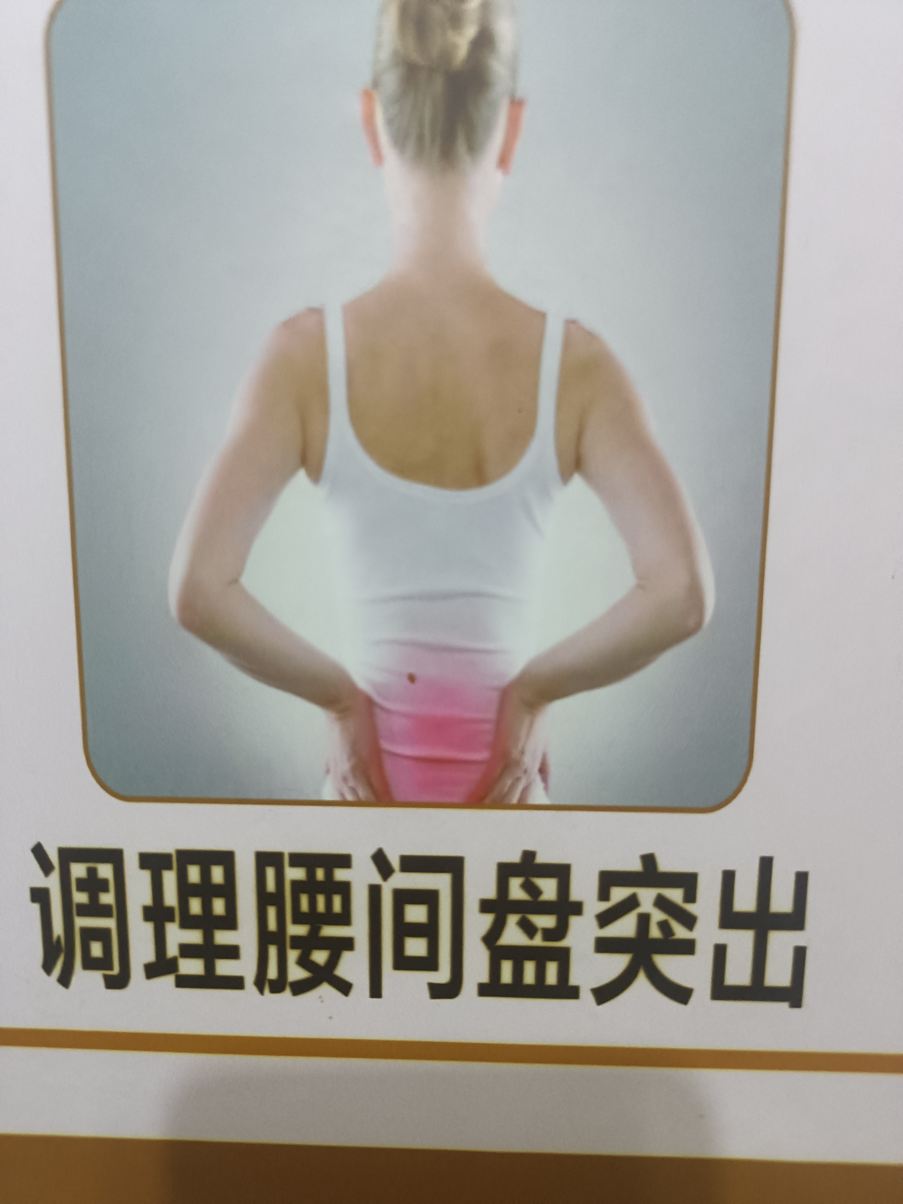 腰椎盘突出