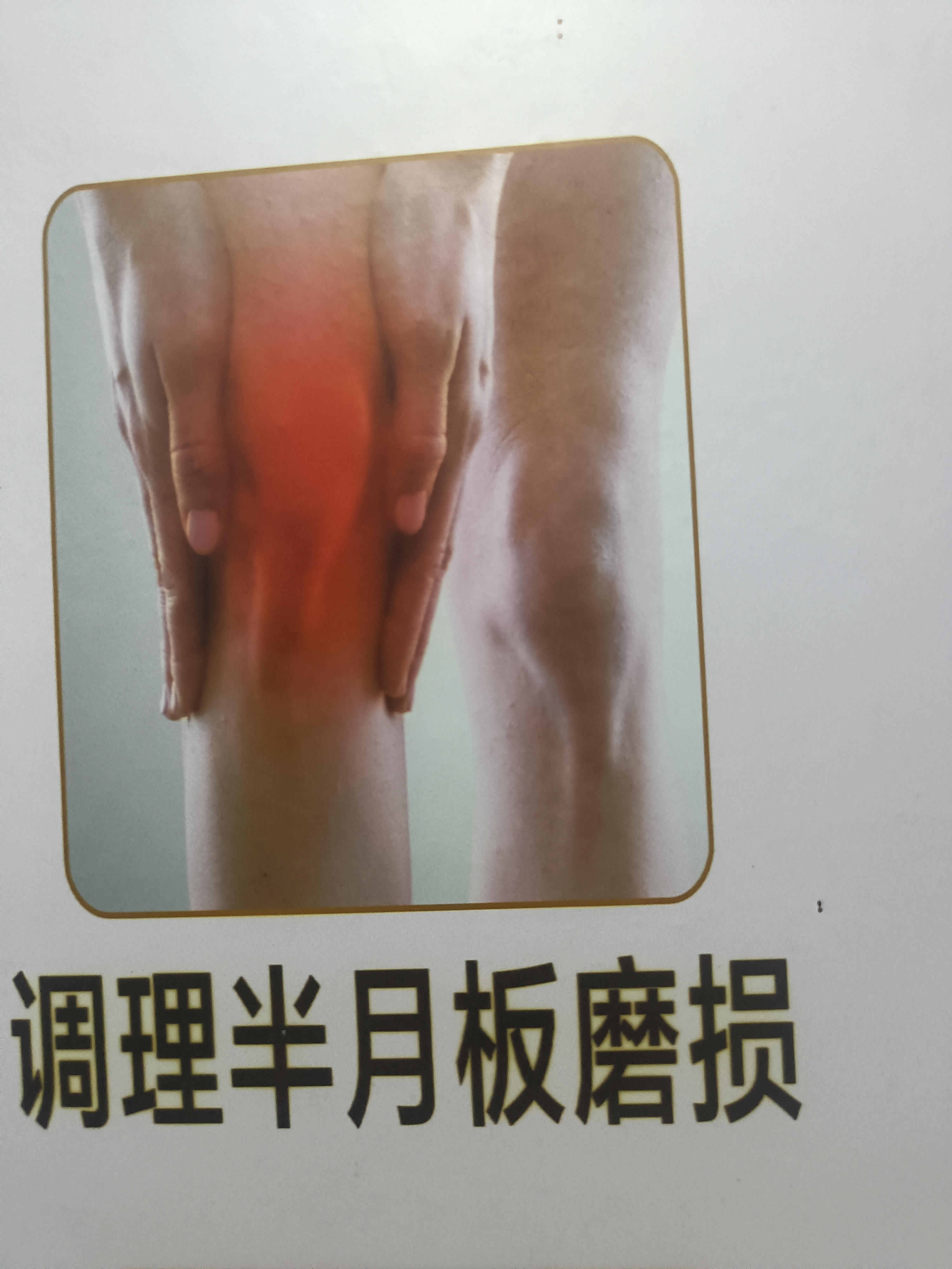 膝关节半月板损伤/次