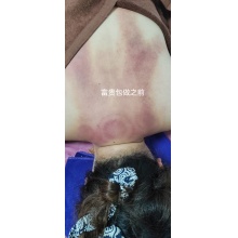 颈肩腰腿疼痛每一个部位单次