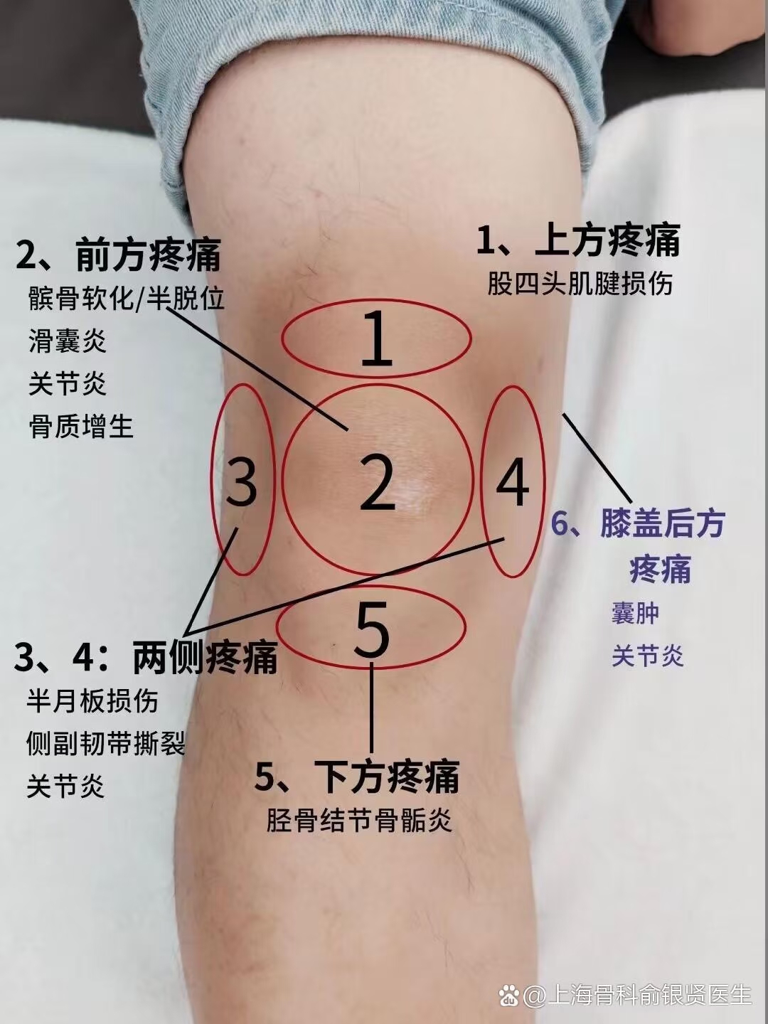 漆关节正骨一次