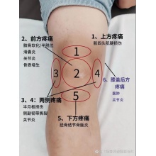 漆关节正骨一次